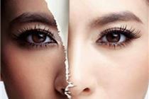 Trị nám da mặt từ thảo dược siêu hiệu quả Trị nám da mặt từ thảo dược siêu hiệu quả